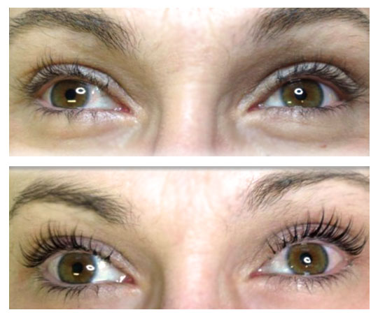 wimpernlifting-up-vorher-nachher-kosmetik-lichtenrade